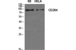 Western Blot (WB) analysis of specific cells using CD284 Polyclonal Antibody. (TLR4 anticorps  (Internal Region))