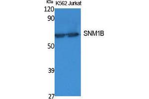 Western Blotting (WB) image for anti-DNA Cross-Link Repair 1B (DCLRE1B) (C-Term) antibody (ABIN3187627)