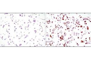 Immunocytochemistry analysis of HCC827 cells, untransfected (left) or transfected with GFP (right) using GFP mouse mAb .