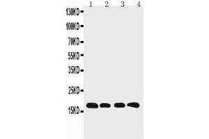 Anti-Cyclophilin B antibody, Western blotting Lane 1: Rat Ovary Tissue Lysate Lane 2: HELA Cell Lysate Lane 3: 293T Cell Lysate Lane 4: A431 Cell Lysate (PPIB anticorps  (C-Term))