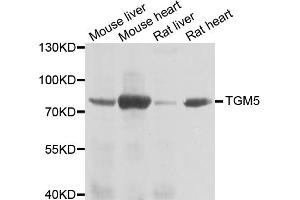 Western blot analysis of extracts of various cell lines, using TGM5 antibody. (Transglutaminase 5 anticorps)