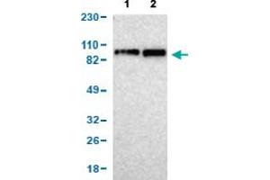 Western Blot analysis of (1) human cell line RT-4, and (2) human cell line U-251MG sp. (KIF2A anticorps  (AA 35-144))