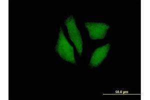 Immunofluorescence of purified MaxPab antibody to MGC5987 on HeLa cell. (MDP1 anticorps  (AA 1-176))