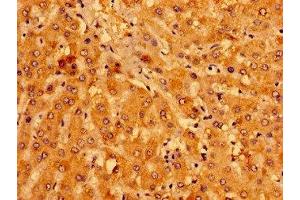 Immunohistochemistry of paraffin-embedded human liver tissue using ABIN7158957 at dilution of 1:100