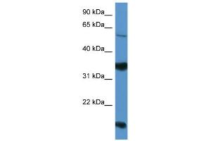 WB Suggested Anti-NTNG2 Antibody Titration: 0.