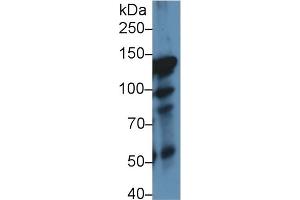 Detection of ITIH4 in Rat Lung lysate using Polyclonal Antibody to Inter Alpha-Globulin Inhibitor H4 (ITIH4) (ITIH4 anticorps  (AA 478-722))