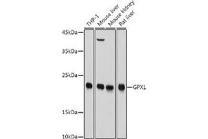 Western blot analysis of extracts of various cell lines, using GPX1 antibody (ABIN3021455, ABIN3021456, ABIN3021457, ABIN1512957 and ABIN6215063) at 1:1000 dilution. (Glutathione Peroxidase 1 anticorps  (AA 50-203))