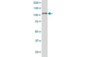 PTK2B monoclonal antibody (M03), clone X1 Western Blot analysis of PTK2B expression in K-562.
