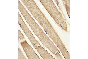 (ABIN652180 and ABIN2840585) staining hABCB10 in Human skeletal muscle tissue sections by Immunohistochemistry (IHC-P - paraformaldehyde-fixed, paraffin-embedded sections).