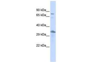 Image no. 1 for anti-Thyrotrophic Embryonic Factor (TEF) (AA 431-480) antibody (ABIN6742378) (TEF anticorps  (AA 431-480))