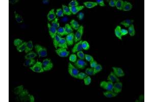 Immunofluorescence staining of Hela cells with ABIN7164473 at 1:100, counter-stained with DAPI.