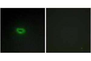 Immunofluorescence (IF) image for anti-Chromosome 2 Open Reading Frame 40 (C2orf40) (AA 41-90) antibody (ABIN2889756) (C2orf40 anticorps  (AA 41-90))