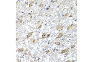 Immunohistochemistry of paraffin-embedded rat brain using HSPA6 antibody at dilution of 1:100 (x40 lens). (HSPA6 anticorps)