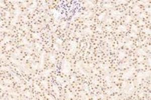 Immunohistochemistry analysis of paraffin-embedded rat kidney using,RanBP16 (ABIN7073901) at dilution of 1: 2000