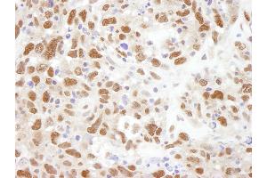 Immunohistochemistry (IHC) image for anti-Budding Uninhibited By Benzimidazoles 3 Homolog (Yeast) (BUB3) (AA 275-325) antibody (ABIN7448449)