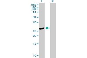 Western Blot analysis of DNAJC27 expression in transfected 293T cell line by DNAJC27 MaxPab polyclonal antibody.