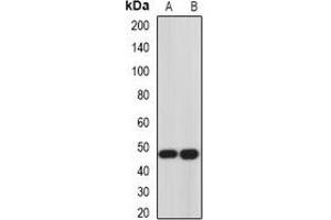 Western blot analysis of Hemojuvelin expression in Hela (A), PC3 (B) whole cell lysates. (HFE2 anticorps)
