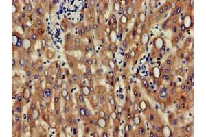 Immunohistochemistry of paraffin-embedded human liver tissue using ABIN7147124 at dilution of 1:100 (CD166 anticorps  (AA 28-516))