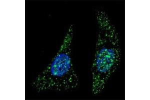 Fluorescent image of U251 cells stained with ATG5 antibody at 1:200. (ATG5 anticorps  (AA 1-30))