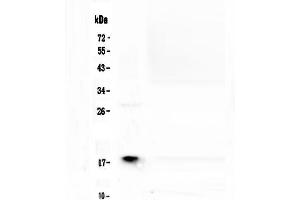 Western blot analysis of MAX using anti-MAX antibody . (MAX anticorps  (AA 30-106))