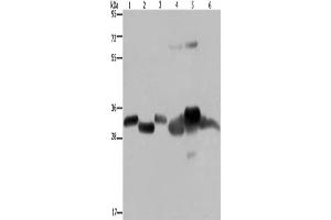 Western Blotting (WB) image for anti-3-Hydroxymethyl-3-Methylglutaryl-CoA Lyase (HMGCL) antibody (ABIN2430231) (HMGCL anticorps)