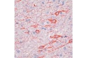 Formalin-fixed, paraffin-embedded human brain stained with Microtubule-Associated Protein 2a,b Ab using peroxidase-conjugate and AEC chromogen.