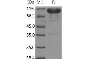 Western Blotting (WB) image for EPH Receptor A7 (EPHA7) (Active) protein (Fc Tag) (ABIN7321214)