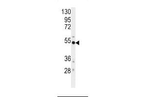 Western blot analysis of anti-BACE Antibody  (ABIN392200 and ABIN2841901) in mouse cerebellum tissue lysates (35 μg/lane).