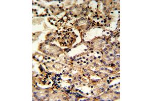 Formalin-fixed and paraffin-embedded kidney tissue reacted with GS Antibody (Center), which was peroxidase-conjugated to the secondary antibody, followed by DAB staining. (GMP Synthase anticorps  (AA 296-325))