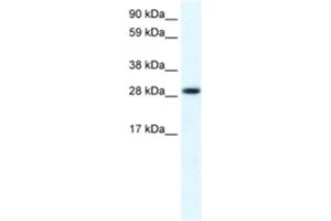 Western Blotting (WB) image for anti-Four and A Half LIM Domains 1 (FHL1) antibody (ABIN2460931) (FHL1 anticorps)