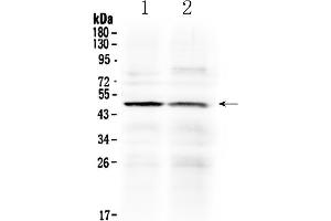 Western blot analysis of HtrA3 using anti- HtrA3 antibody . (HTRA3 anticorps  (C-Term))