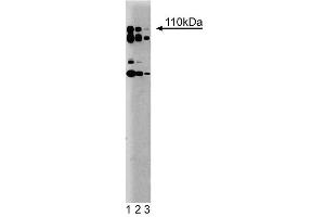 Western blot analysis of PI3-Kinase p110delta on a rat cerebrum lysate. (PIK3CD anticorps  (AA 73-90))