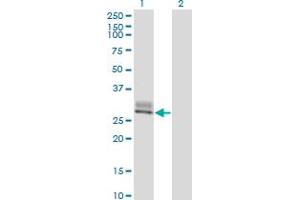 Western Blot analysis of SPINT2 expression in transfected 293T cell line by SPINT2 monoclonal antibody (M01), clone 2D1.
