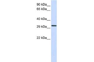 WB Suggested Anti-C21orf2 Antibody Titration:  0. (C21orf2 anticorps  (N-Term))