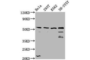Western Blot Positive WB detected in: Hela whole cell lysate, 293T whole cell lysate, K562 whole cell lysate, SH-SY5Y whole cell lysate All lanes: RUFY3 antibody at 3. (RUFY3 anticorps  (AA 243-352))