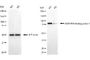 Western blotting analysis using EWS RNA binding protein 1 antibody (ABIN7798536).