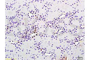 Formalin-fixed and paraffin embedded rat brain tissue labeled with Anti phospho-MAP3K9+MAP3K10(Thr312+Thr266) Polyclonal Antibody, Unconjugated (ABIN872294) at 1:200 followed by conjugation to the secondary antibody and DAB staining (MAP3K9 anticorps  (pThr312))