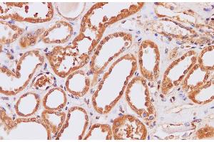 Immunohistochemistry of paraffin-embedded Human kidney using ITPKB Polyclonal Antibody at dilution of 1:200