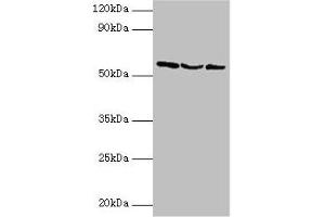 Western blot All lanes: USP14 antibody at 2 μg/mL Lane 1: Hela whole cell lysate Lane 2: 293T whole cell lysate Lane 3: NIH/3T3 whole cell lysate Secondary Goat polyclonal to rabbit IgG at 1/10000 dilution Predicted band size: 57, 53, 55 kDa Observed band size: 57 kDa (USP14 anticorps  (C-Term))