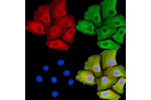 ABIN7095310 and ABIN7099367 staining Hela cells by IF/ICC.