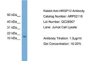WB Suggested Anti-HRSP12  Antibody Titration: 0. (HRSP12 anticorps  (N-Term))
