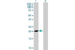 Western Blot analysis of LOC285697 expression in transfected 293T cell line by LOC285697 MaxPab polyclonal antibody. (TAF11L1 anticorps  (AA 1-183))