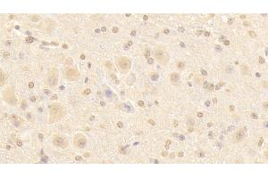 Detection of NUP133 in Mouse Cerebellum Tissue using Polyclonal Antibody to Nucleoporin 133 (NUP133) (NUP133 anticorps  (AA 36-240))