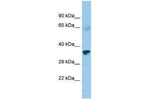 Host: Rabbit Target Name: ZNF330 Sample Type: Fetal Heart lysates Antibody Dilution: 1. (ZNF330 anticorps  (C-Term))