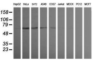 Image no. 2 for anti-Tripartite Motif Containing 38 (TRIM38) (AA 1-265) antibody (ABIN1490688) (TRIM38 anticorps  (AA 1-265))