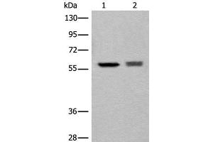 Western blot analysis of EPG2 and Jurkat cell lysates using ATL3 Polyclonal Antibody at dilution of 1:800 (ATL3 anticorps)