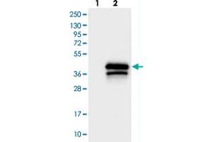 Western blot analysis of Lane 1: Negative control (vector only transfected HEK293T lysate), Lane 2: Over-expression Lysate (Co-expressed with a C-terminal myc-DDK tag (~3. (TREML1 anticorps)
