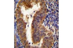 Immunohistochemistry analysis in formalin fixed and paraffin embedded human uterus tissue reacted with BNIP3L / BNIP3A Antibody (Center) followed which was followed by peroxidase conjugated to the secondary antibody and DAB staining. (BNIP3L/NIX anticorps  (Middle Region))