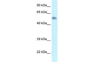 WB Suggested Anti-Zfp472 Antibody   Titration: 1. (Zfp472 anticorps  (N-Term))