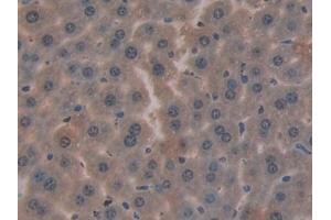 Detection of CYR61 in Mouse Liver Tissue using Polyclonal Antibody to Cysteine Rich Protein, Angiogenic Inducer 61 (CYR61)